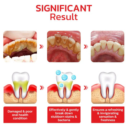 SP4 Ultra Whitening Probiotic Toothpaste